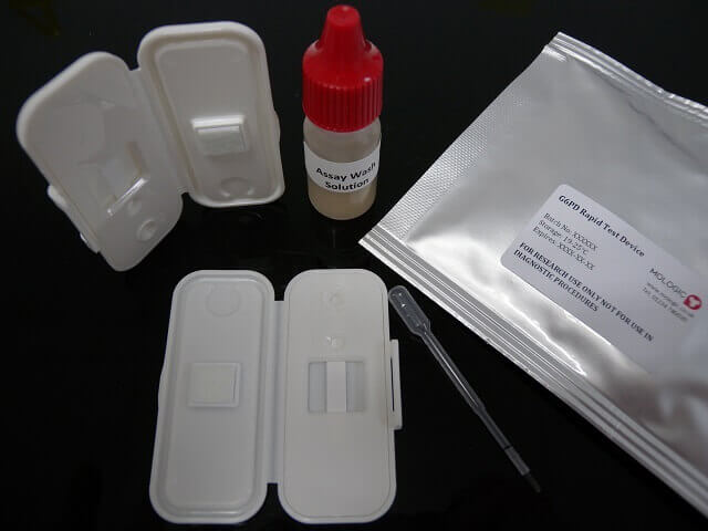 PATH rapid diagnostic test to support treatment and elimination of P. vivax. Photo: PATH