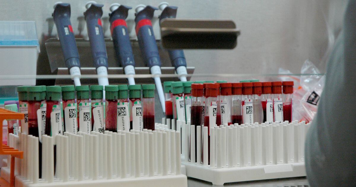 Research Roundup : Novel gonorrhea drug , WHO prequalifies HIV test , Rift Valley fever vaccine